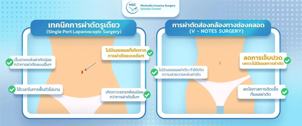 แนวทางการรักษาเนื้องอกในมดลูก