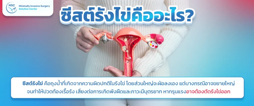 ซีสต์รังไข่คืออะไร?