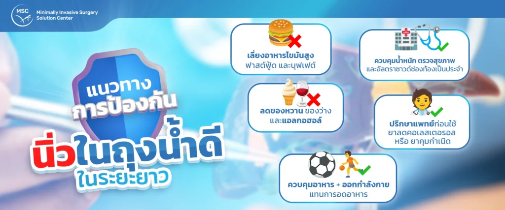 แนวทางการป้องกันนิ่วในถุงน้ำดีในระยะยาว