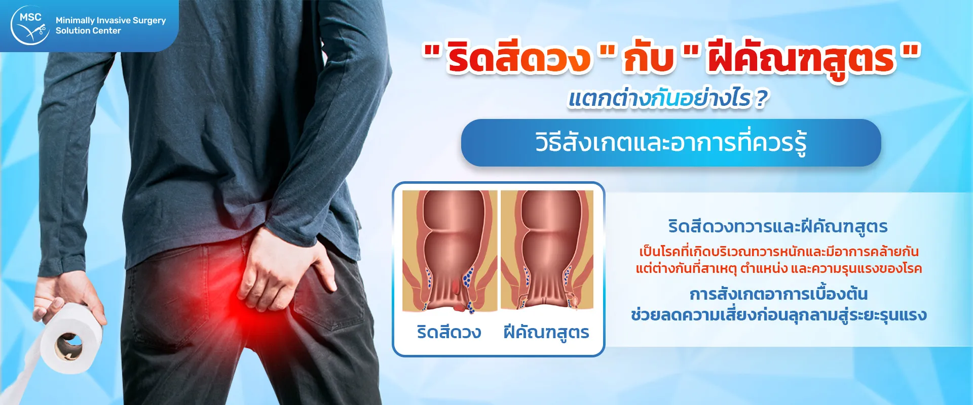 โรคริดสีดวง