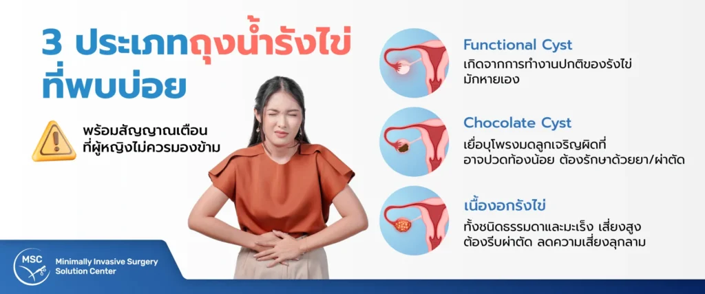 ชนิดของถุงน้ำรังไข่ที่พบบ่อย
