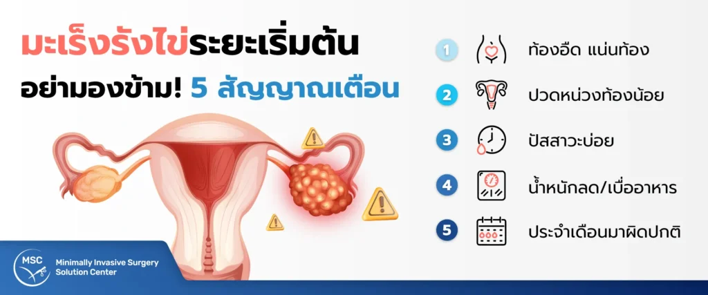 อาการมะเร็งรังไข่ระยะเริ่มต้น