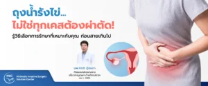 ผ่าตัดถุงน้ำรังไข่