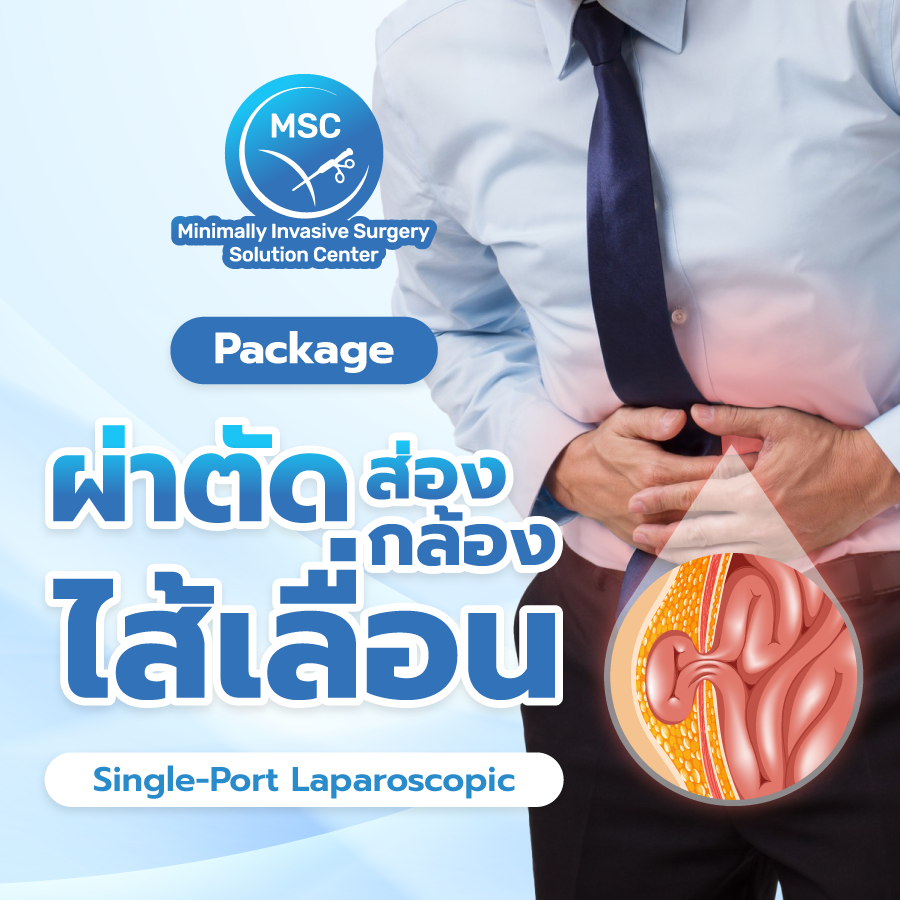 แพ็กเกจผ่าตัดส่องกล้องไส้เลื่อน