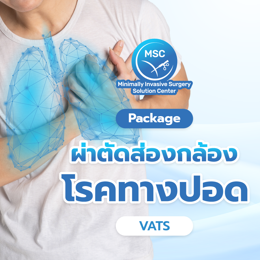 แพ็กเกจผ่าตัดส่องกล้องโรคทางปอด