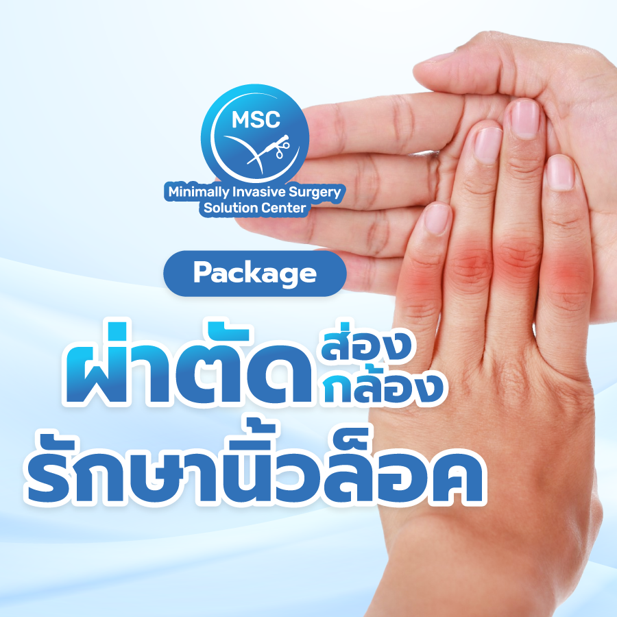 แพ็กเกจผ่าตัดส่องกล้องรักษานิ้วล็อค
