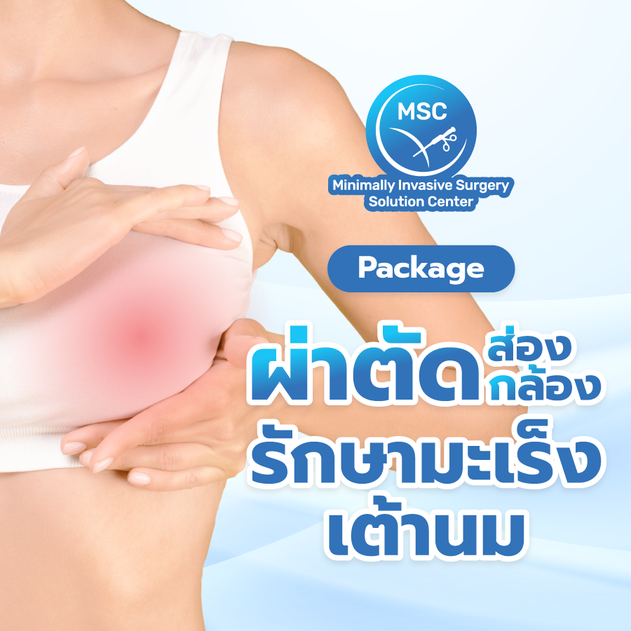 แพ็กเกจผ่าตัดส่องกล้องรักษามะเร็งเต้านม
