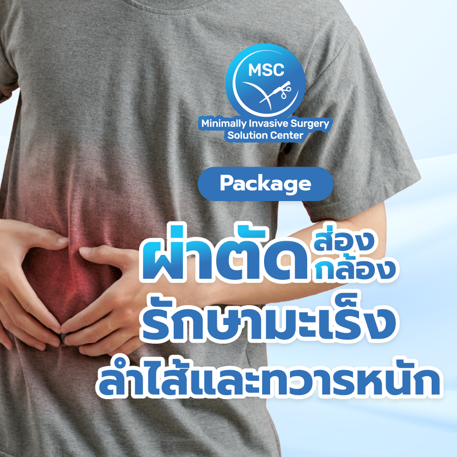 แพ็กเกจผ่าตัดส่องกล้องรักษามะเร็งลำไส้และทวารหนัก