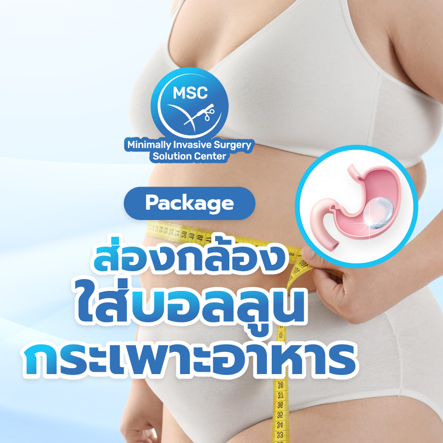 แพ็กเกจส่องกล้องใส่บอลลูนกระเพาะอาหาร